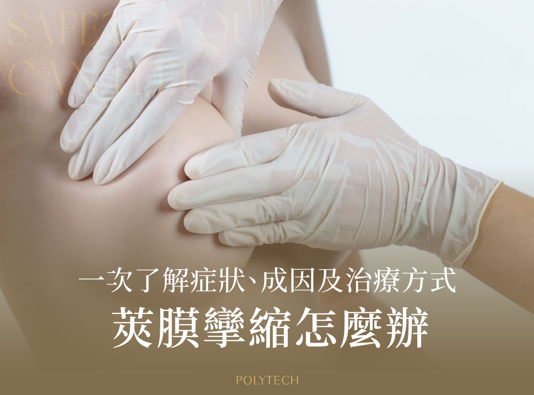 莢膜攣縮怎麼辦,從醫學分級一次了解症狀、成因以及治療方式 莢膜攣縮怎麼辦,從醫學分級一次了解症狀、成因以及治療方式 - MESMO繆思女神波|POLYTECH